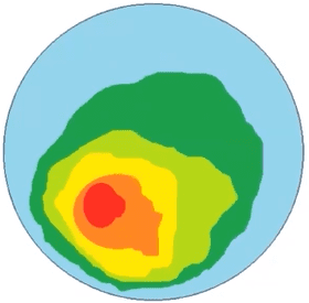 vitesse asymétrique