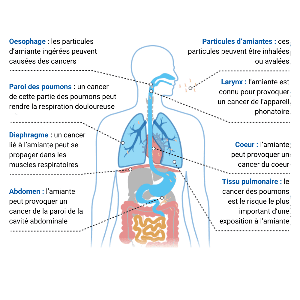 asbestos exposure risks